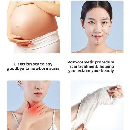 Silicone Gel Scar Removal Patch