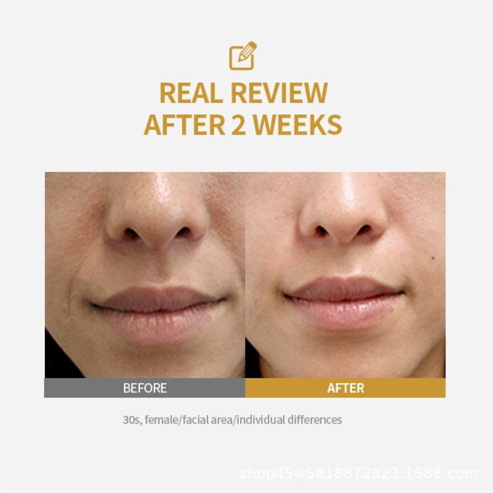 Collagen Peptide Bottle-Formed Needle Tube Essence Liquid