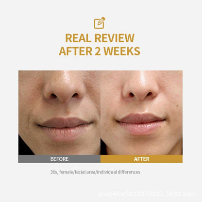 Collagen Peptide Bottle-Formed Needle Tube Essence Liquid